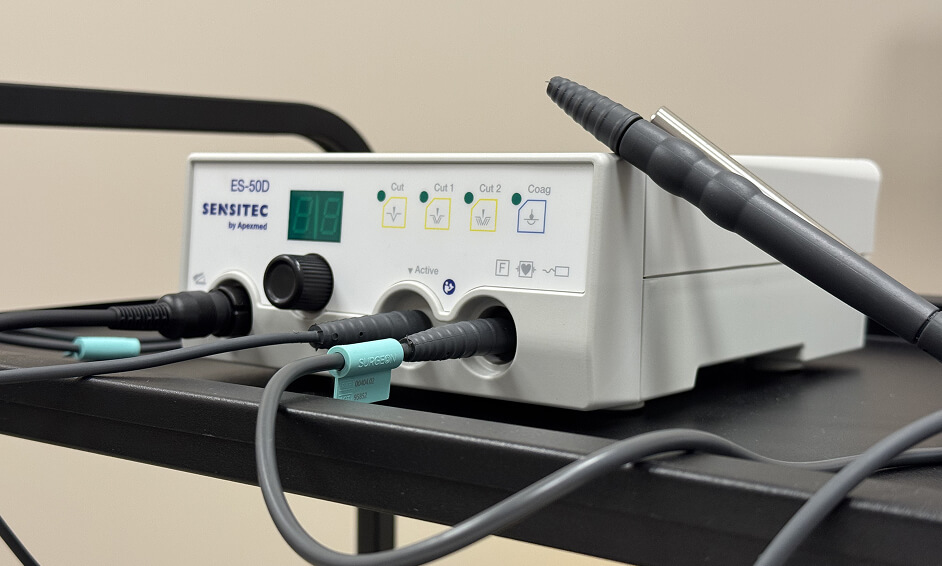 Удаление новообразований Sensitec ES-50D (Нидерланды)